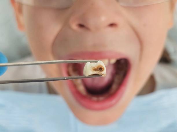 Best Emergency Treatment for Toothache in Monona, WI